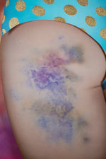 "Ma Bum Bruise" Giclée Print