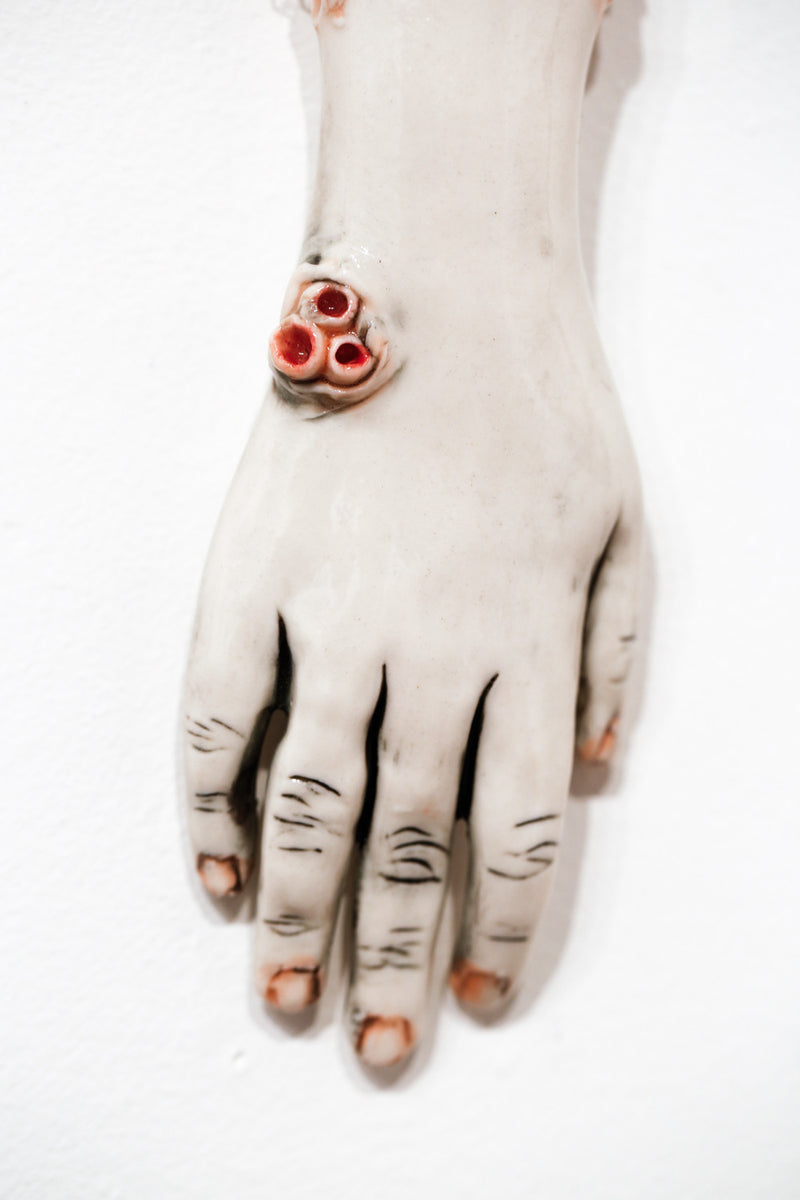 The Long Arm Reaches Out: Hands and Feet Series 34