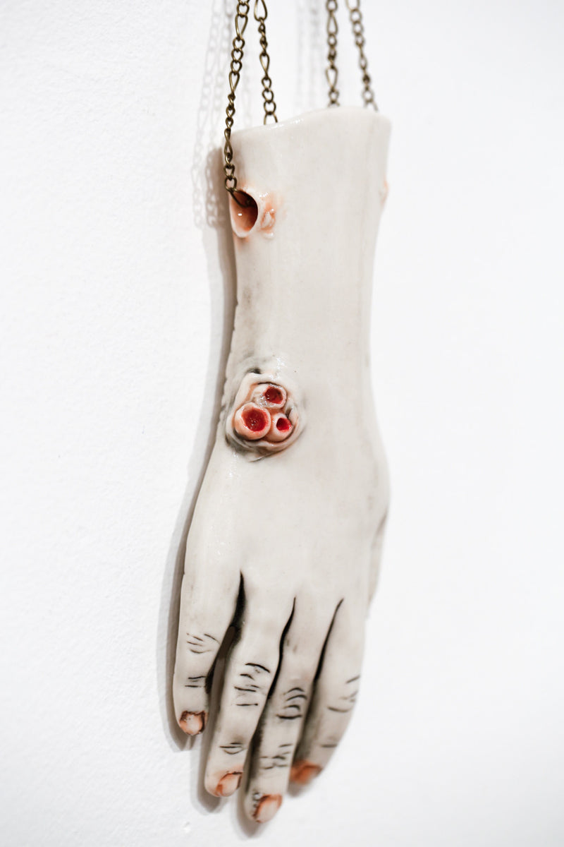 The Long Arm Reaches Out: Hands and Feet Series 34