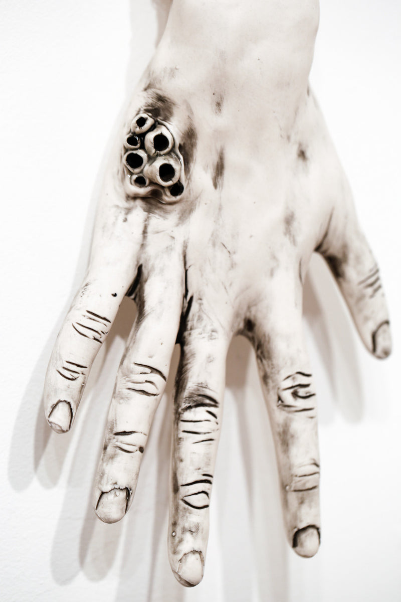 The Long Arm Reaches Out: Hands and Feet Series 52