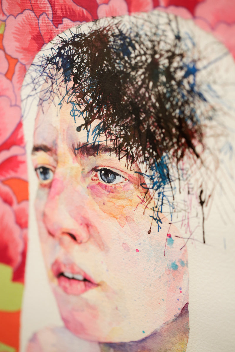 Concussion