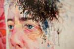 Concussion