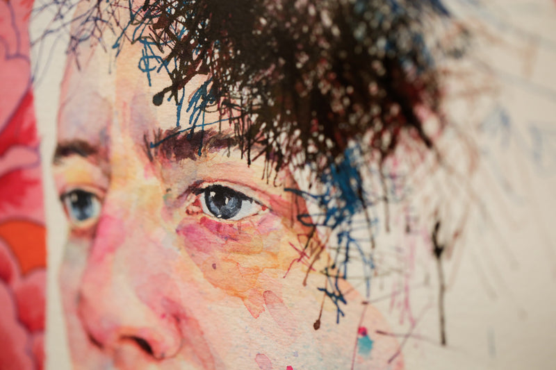 Concussion