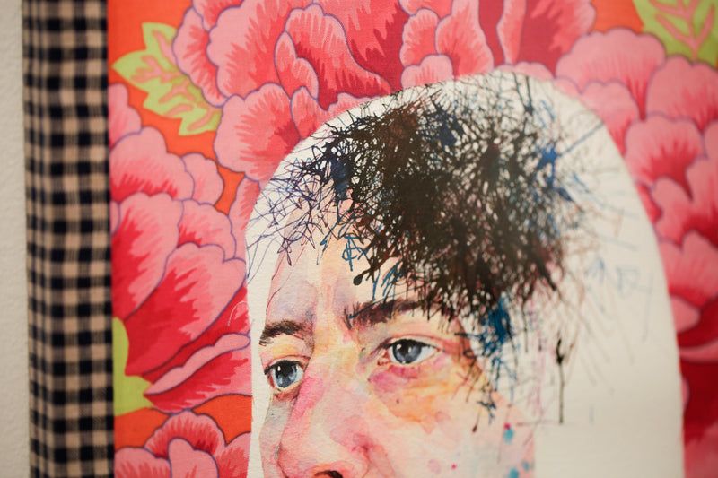 Concussion